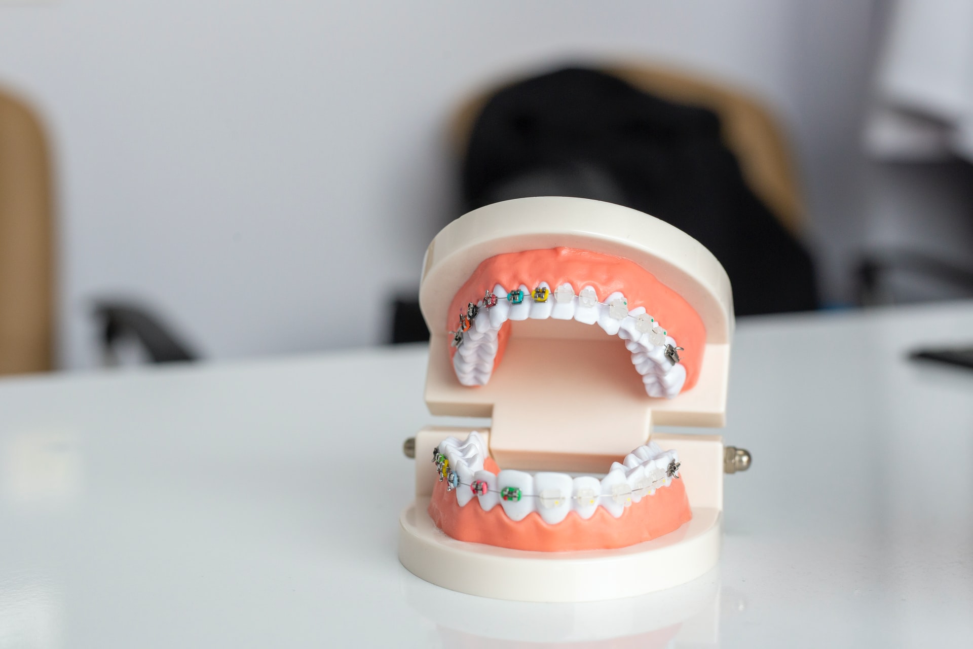 Braces Model on Dentist Desk