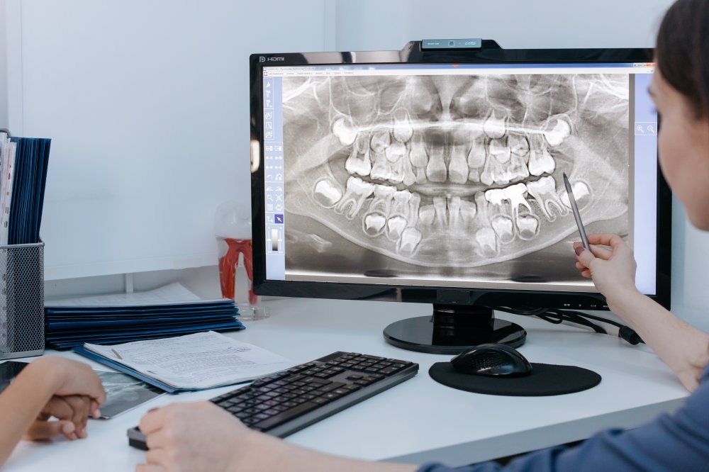 Dental X-Rays: Why Are They Important